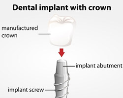 Nipomo Dentist