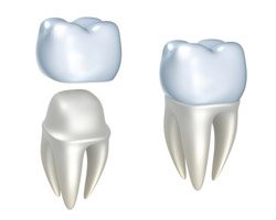 Nipomo Dentist - CAP